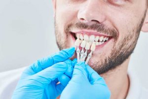 Read more about the article How Do Dental Veneers Support Dental Health?